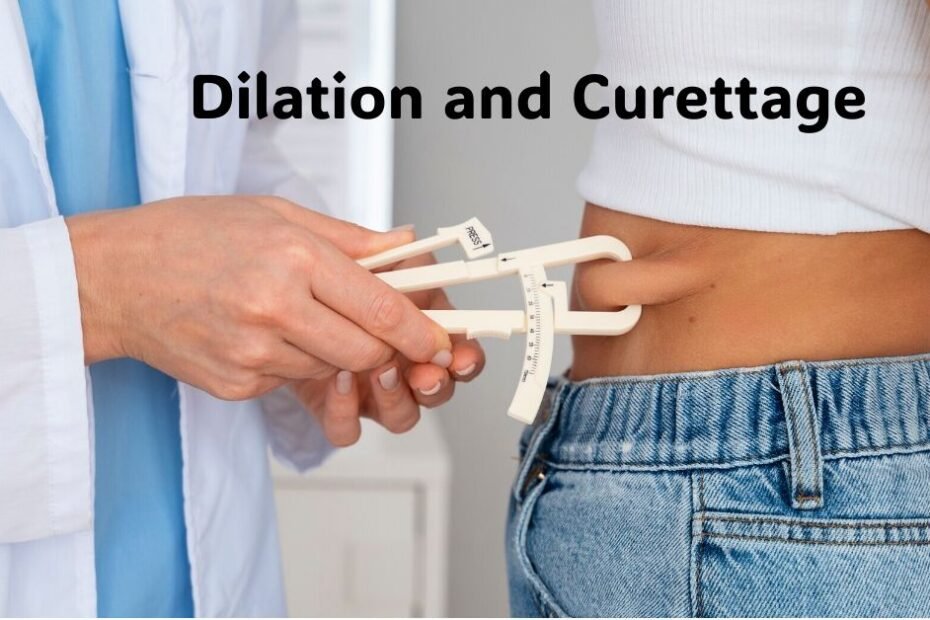 Dilation and Curettage