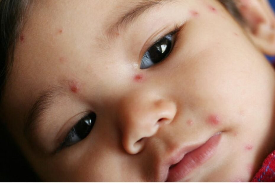 Children's Rashes and Skin Conditions