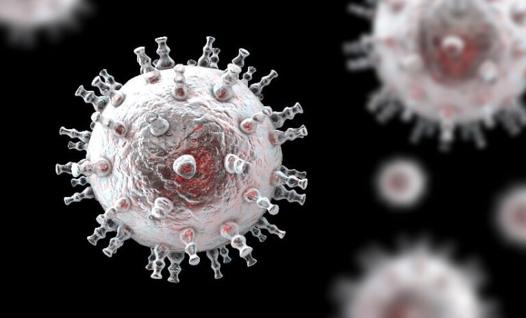 Kaposi Sarcoma: Gene Variant Linked to HIV Risk