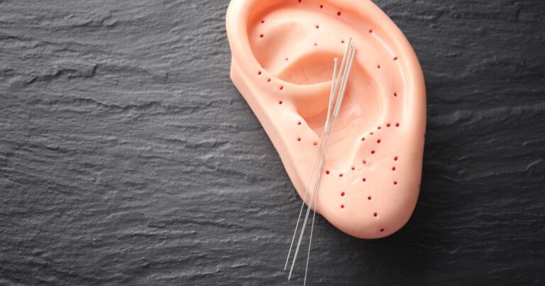 New ear acupuncture may help reduce migraine pain