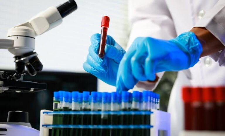 Serum REG3α for Ulcerative Colitis Monitoring