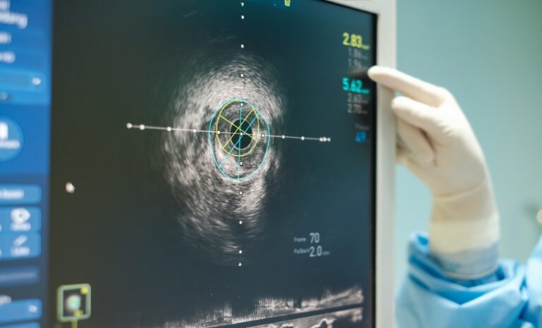 UK Consensus Promotes Intravascular Ultrasound Use – EMJ