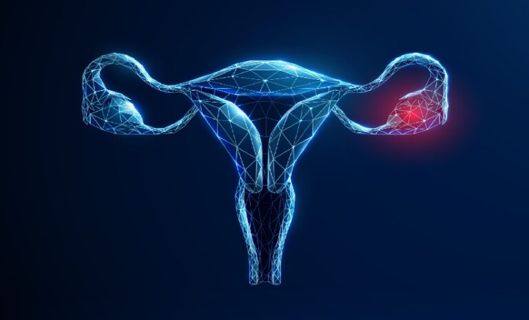 Adnexal Lesions Pregnancy: Ultrasound Findings