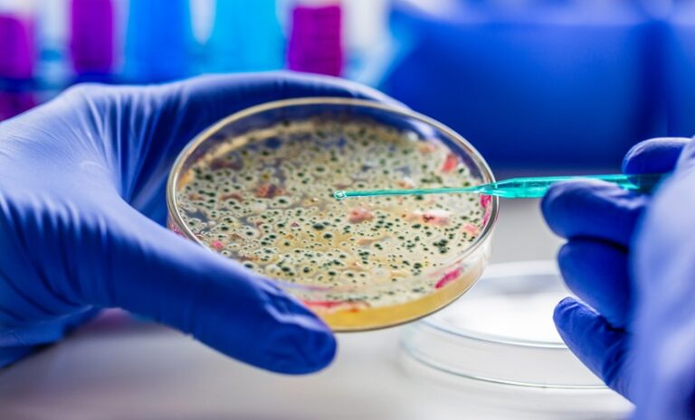 Medical diagnostic laboratory. Culture of microbiological material in a microbiological laboratory.